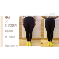日式小颜整骨整的是什么？