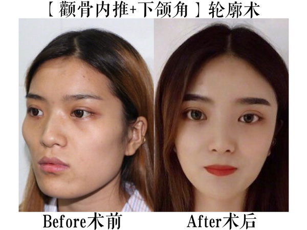 上海金一秀 