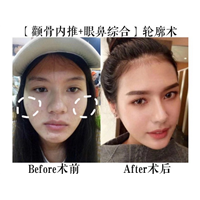 金一秀磨骨