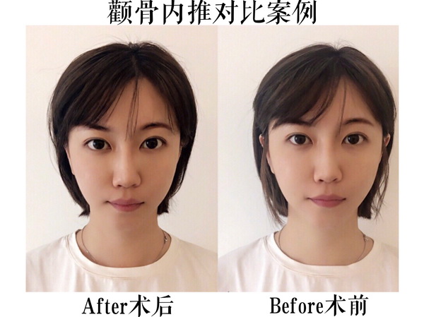 金一秀做的磨骨怎么样 