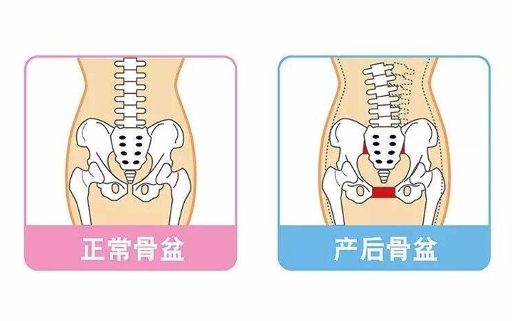 盆骨修复 