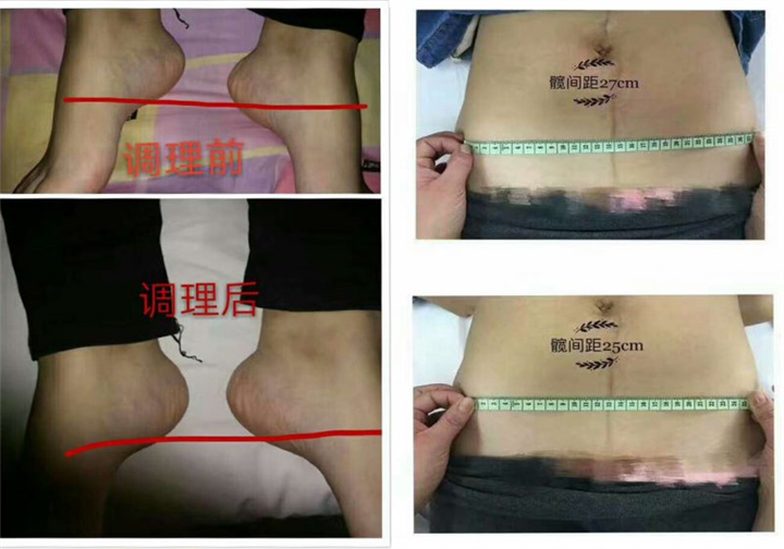 前后效果 