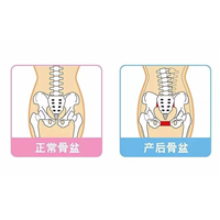 盆骨修复 