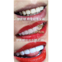 伊斯顿美牙
