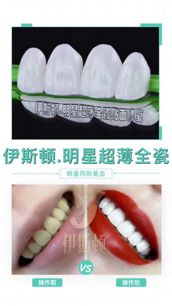 伊斯顿总部