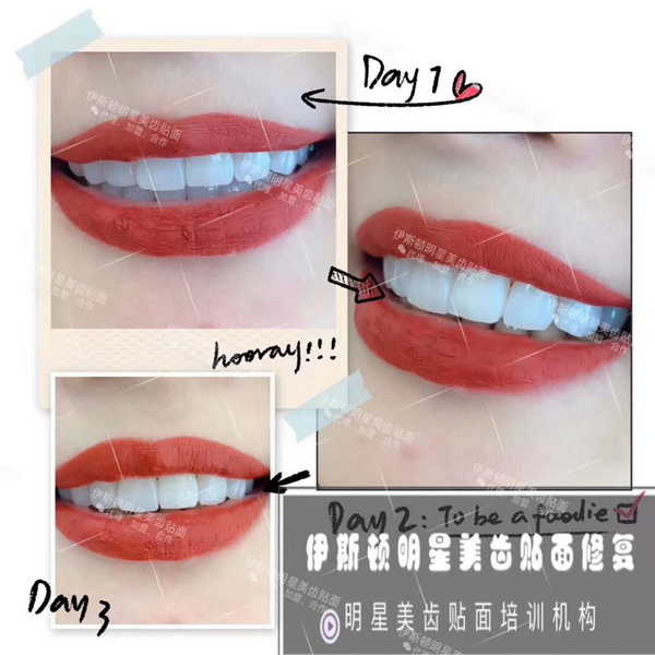 伊斯顿美牙培训 