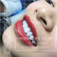 冰瓷美牙培训