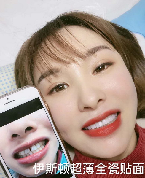 成都牙齿美白培训