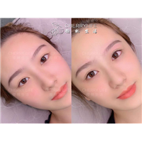 揭阳做半**哪家好