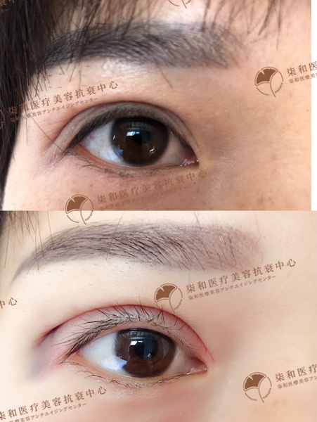 长沙专业整形修复