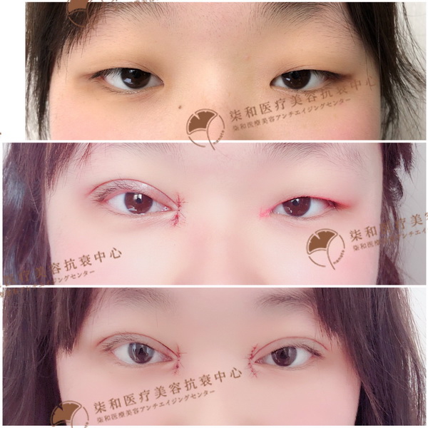 长沙专业整形修复