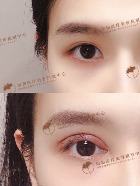 长沙网红整形