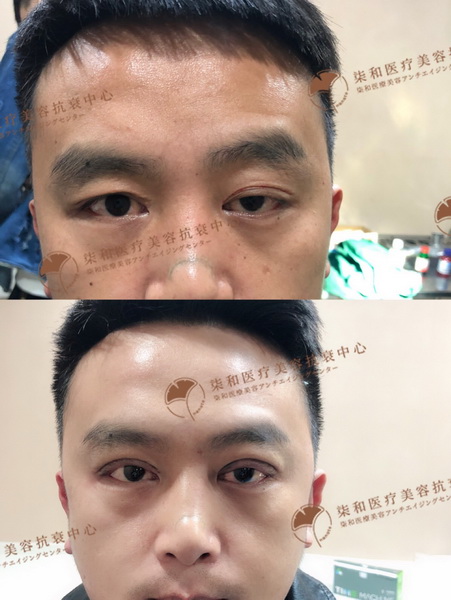 长沙专业整形修复