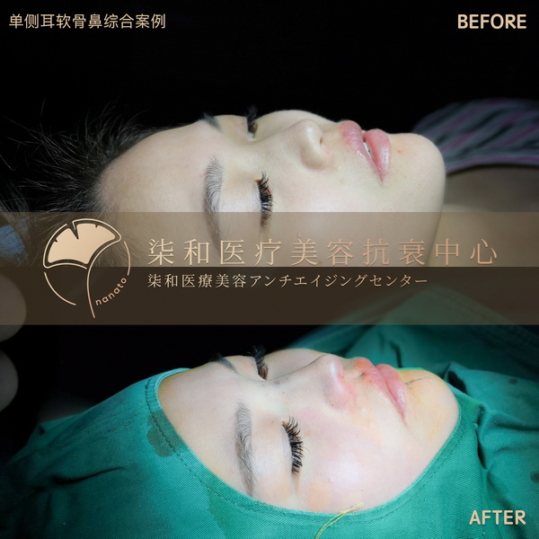 长沙网红整形
