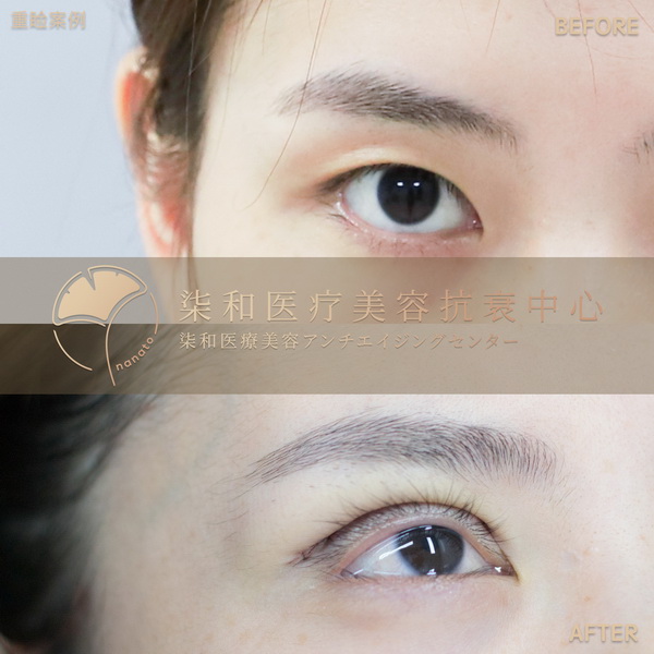 长沙专业整形修复