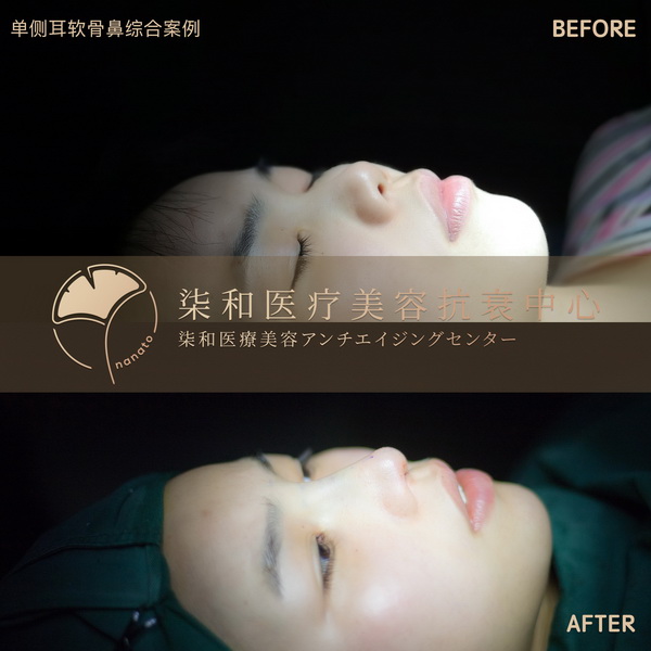 长沙专业整形修复