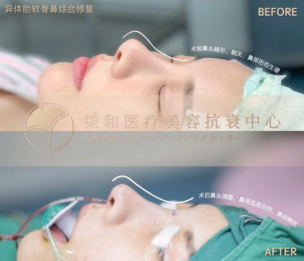 长沙专业整形修复