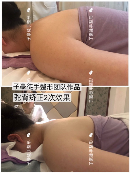 徒手整形 