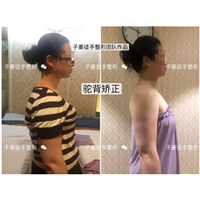徒手整形培训 