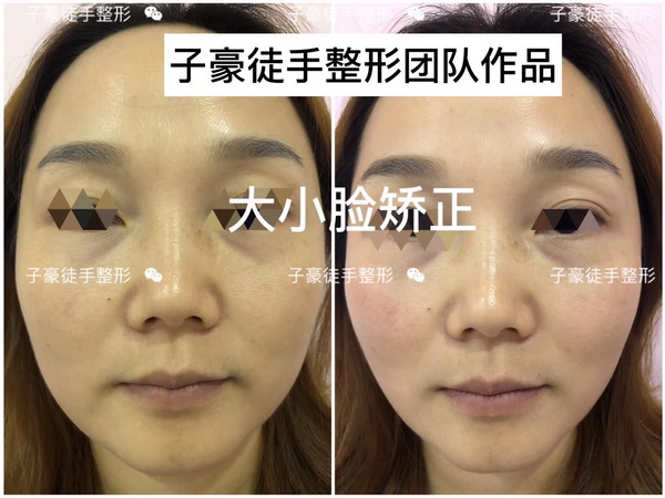 徒手整形培训 