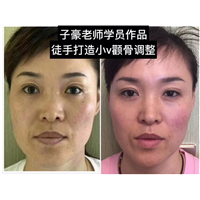 子豪徒手整形 