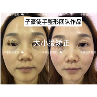 徒手整形培训 
