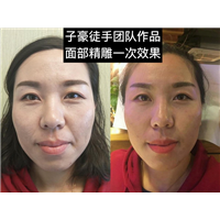子豪徒手整形 