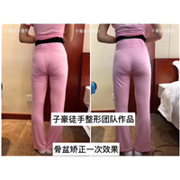 子豪徒手整形 