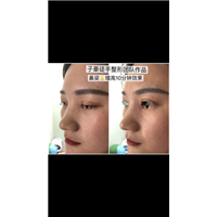 徒手整形培训 