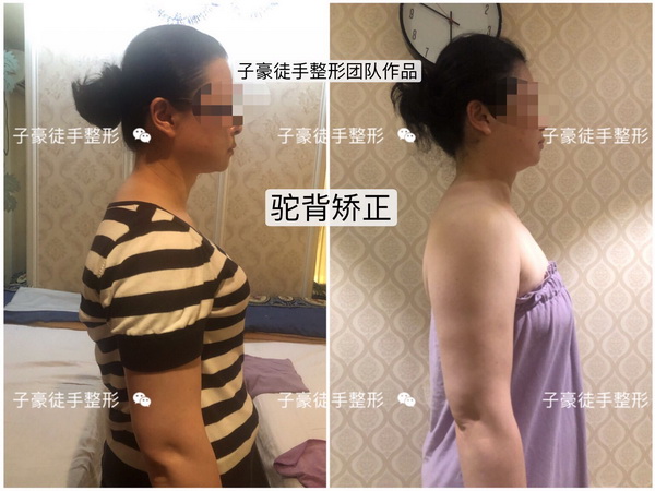 徒手整形培训 