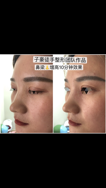 徒手整形培训 