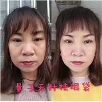 量子无针微整培训学校 