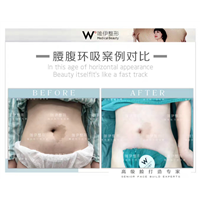 广州吸脂整形医院