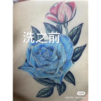 南充皮秒快速洗纹身