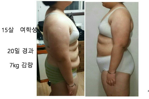 柯模思减肥产品