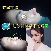 北京高级脸定制