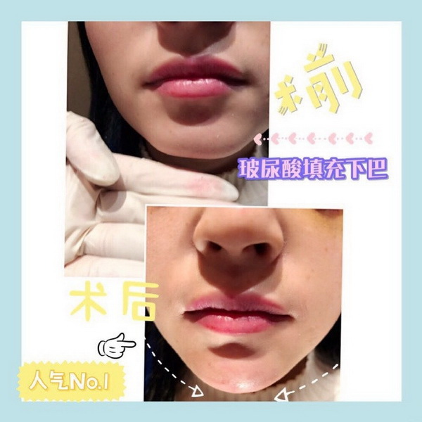 南宁眼综合整形