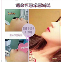 南宁眼综合整形