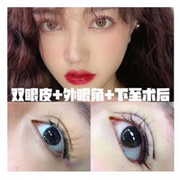 南宁丰胸整形哪家好