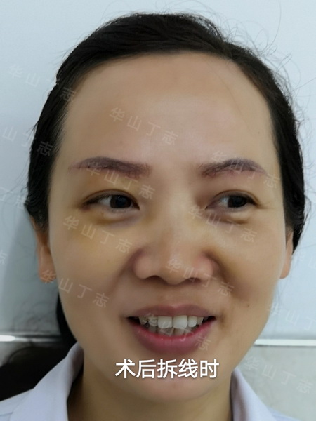 上海面部年轻化专家_上海眼综合专家_丁志 