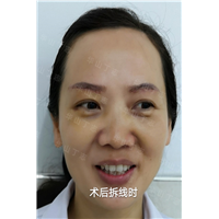 丁志_丁志整形_丁志医生_上海眼综合专家_上海眼综合修复专家 