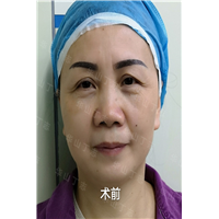 上海整形医生丁志_上海眼综合整形专家_上海整形专家丁志 