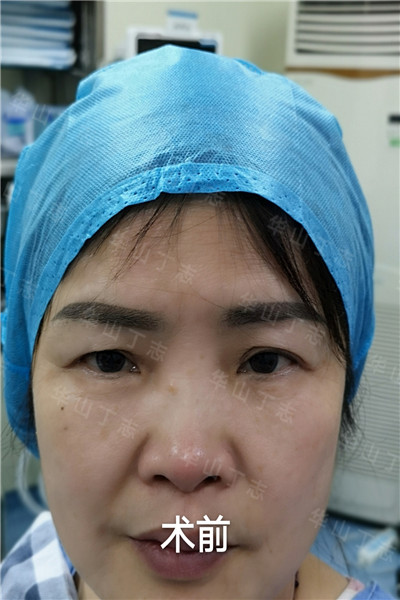 上海眼综合专家_上海眼综合修复专家_上海整形专家 
