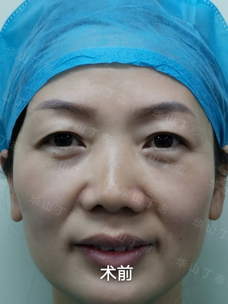 丁志 