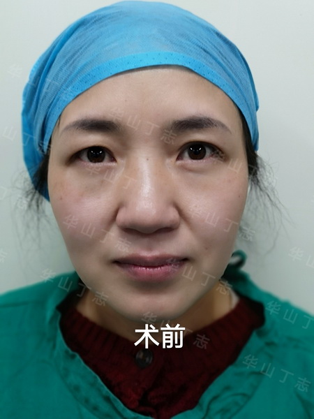 上海修复整形专家_上海整形修复医生 
