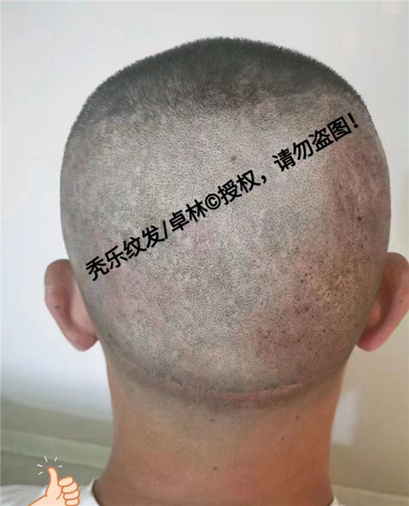 纹发