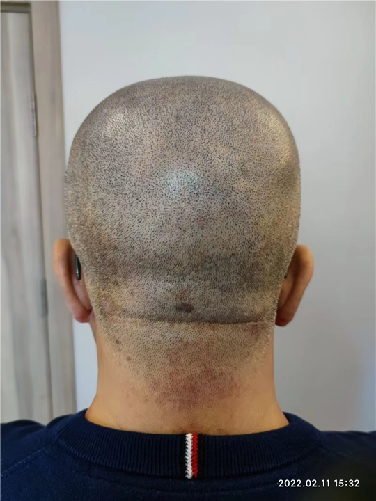 纹发机构哪家好__专业正规smp纹发机构-北京秃乐纹发-