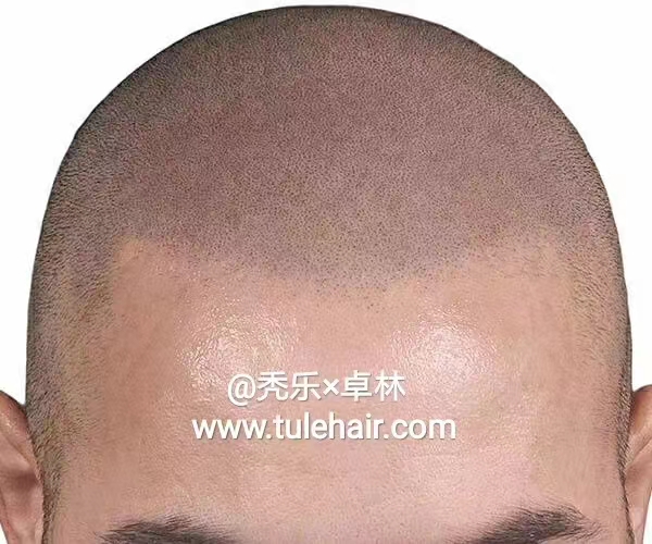 纹发_纹发价格_-北京秃乐纹发-