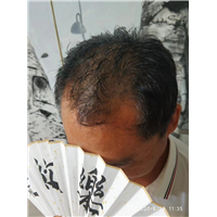 纹发