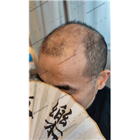 【北京纹发电话】如何选择纹发机构